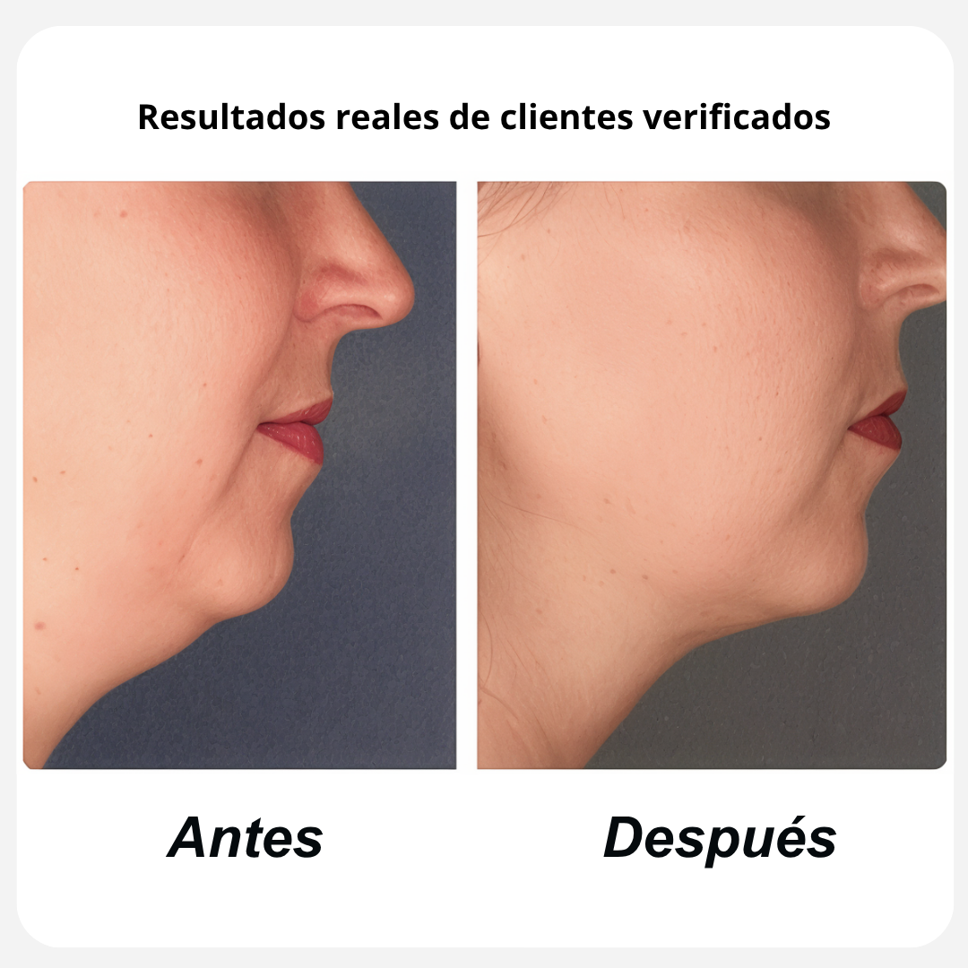 GlowDrain - Lymphatic Drainage Capsules