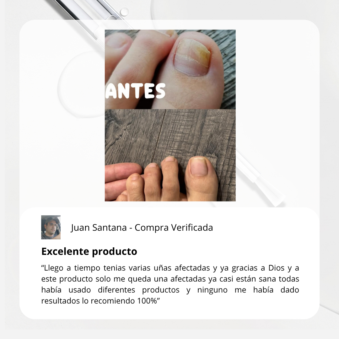 FungaClear Antifungal Pen™